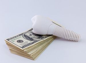 Dental implant sitting on stack of money