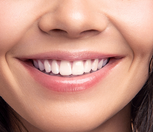 Close-up of woman smiling and showing teeth