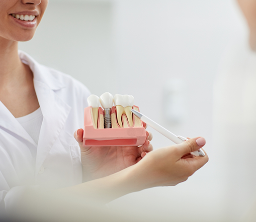 Dentist holding model of dental implant in West Palm Beach