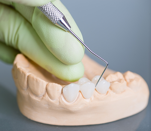 Working with dental bridge on model of teeth